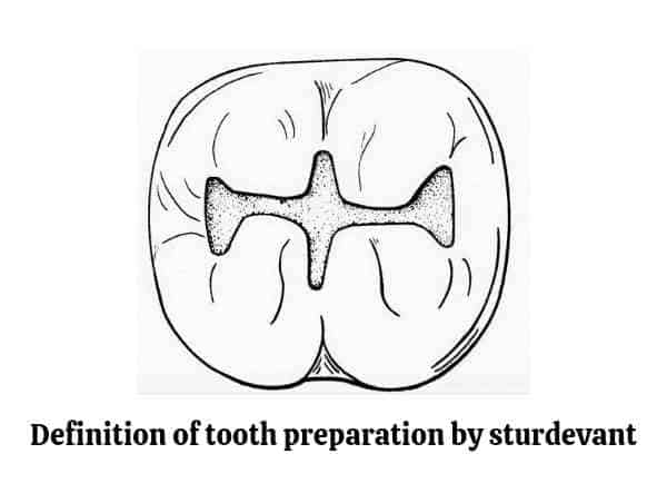 definition of tooth preparation by sturdevant