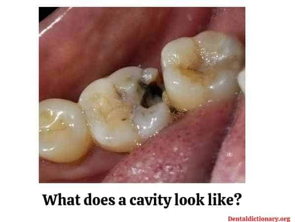 dental cavity logo
