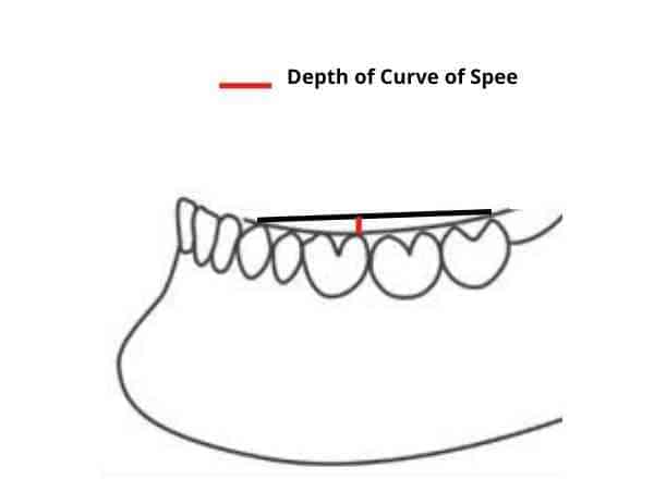 how to measure curve of spee on cast