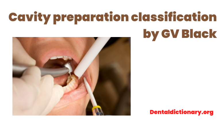 Cavity Preparation Classification by GV Black