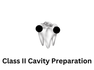 Class II Cavity Preparation