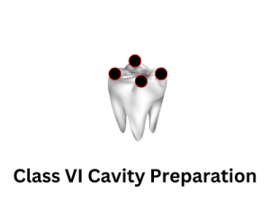 Class VI Cavity Preparation